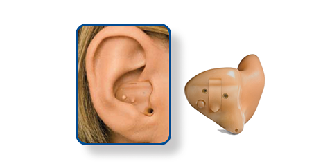 Half Shell - HS - Hearing Aid Style - Shreveport, LA - The ENT Center, AMC